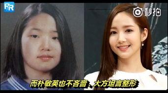 韩国明星做鼻子视频,热门视频带你了解鼻整形全过程